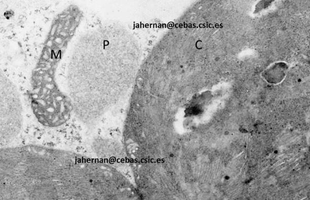 Fig. 1. Micrografía mostrando la cercanía de cloroplastos (C), peroxisomas (P) y mitocondrias (M) en una célula vegetal de una planta C3. Micrografía tomada en cooperación con el Dr. Enrique Olmos (CEBAS-CSIC)